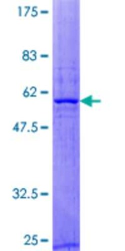 Novus Biologicals Recombinant Human RAB40B GST (N-Term) Protein 10 &mu;g | Buy Online | Novus Biologicals&trade; | Fisher Scientific