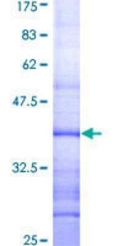 Novus Biologicals Recombinant Human RAB40B GST (N-Term) Protein 2 &mu;g | Buy Online | Novus Biologicals&trade; | Fisher Scientific