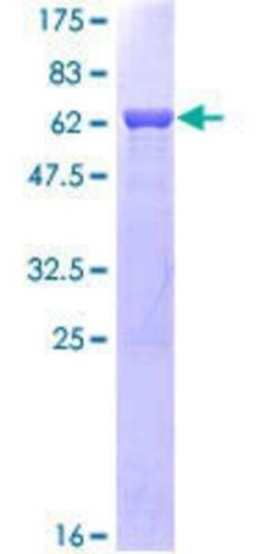 Novus Biologicals Recombinant Human JAB1 GST (N-Term) Protein 25 &mu;g | Buy Online | Novus Biologicals&trade; | Fisher Scientific