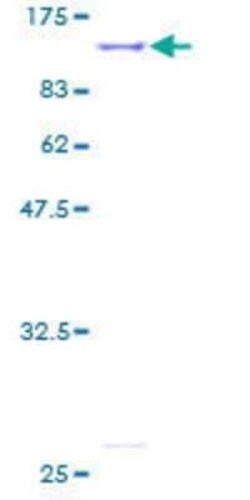 Novus Biologicals Recombinant Human Mitofilin GST (N-Term) Protein 2 &mu;g | Buy Online | Novus Biologicals&trade; | Fisher Scientific