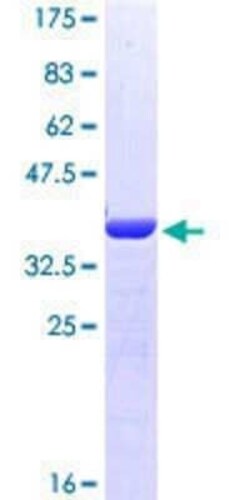 Novus Biologicals Recombinant Human Mitofilin GST (N-Term) Protein 10 &mu;g | Buy Online | Novus Biologicals&trade; | Fisher Scientific