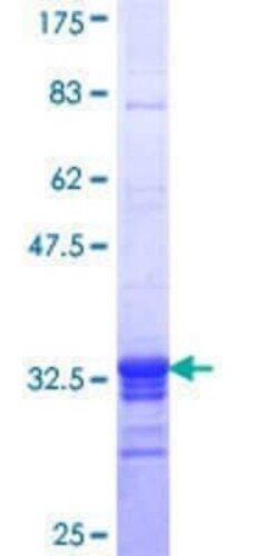 Novus Biologicals Recombinant Human SF3B2 GST (N-Term) Protein 10 &mu;g | Buy Online | Novus Biologicals&trade; | Fisher Scientific