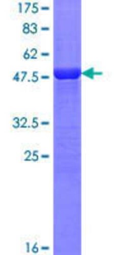 Novus Biologicals&trade;&nbsp;Recombinant Human FATP4/SLC27A4 GST (N-Term) Protein