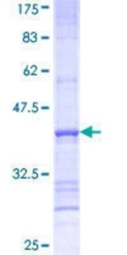 Novus Biologicals Recombinant Human FATP3/SLC27A3 GST (N-Term) Protein 25 &mu;g | Buy Online | Novus Biologicals&trade; | Fisher Scientific