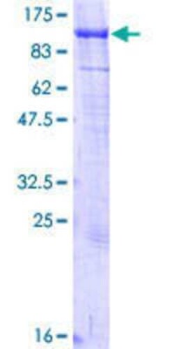 Novus Biologicals Recombinant Human KIF2C GST (N-Term) Protein 10 &mu;g | Buy Online | Novus Biologicals&trade; | Fisher Scientific
