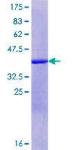 Novus Biologicals Recombinant Human CCDC85B GST (N-Term) Protein 10 &mu;g | Buy Online | Novus Biologicals&trade; | Fisher Scientific