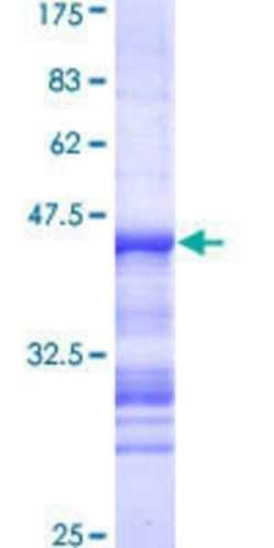 Novus Biologicals Recombinant Human TLK2 GST (N-Term) Protein 10 &mu;g | Buy Online | Novus Biologicals&trade; | Fisher Scientific