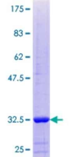 Novus Biologicals Recombinant Human NB thymosin beta GST (N-Term) Protein 25 &mu;g | Buy Online | Novus Biologicals&trade; | Fisher Scientific