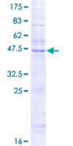 Novus Biologicals Recombinant Human KDELR2 GST (N-Term) Protein 2 &mu;g | Buy Online | Novus Biologicals&trade; | Fisher Scientific