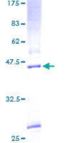 Novus Biologicals Recombinant Human KDELR3 GST (N-Term) Protein 25 &mu;g | Buy Online | Novus Biologicals&trade; | Fisher Scientific
