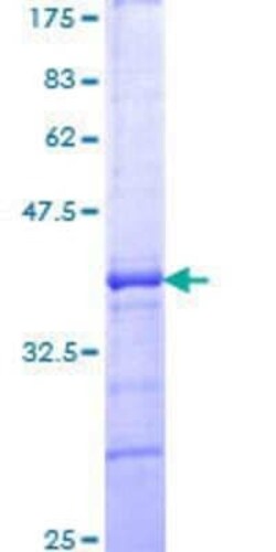 Novus Biologicals Recombinant Human ATF7 GST (N-Term) Protein 10 &mu;g | Buy Online | Novus Biologicals&trade; | Fisher Scientific
