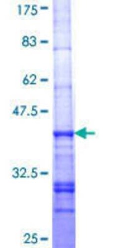 Novus Biologicals Recombinant Human LIAS GST (N-Term) Protein 25 &mu;g | Buy Online | Novus Biologicals&trade; | Fisher Scientific