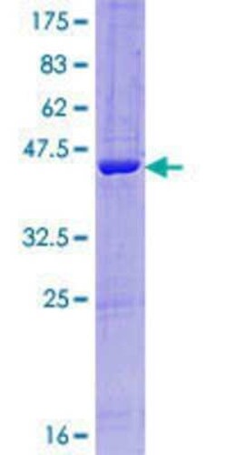 Novus Biologicals Recombinant Human RABL4 GST (N-Term) Protein 10 &mu;g | Buy Online | Novus Biologicals&trade; | Fisher Scientific