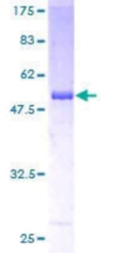 Novus Biologicals Recombinant Human RBPMS GST (N-Term) Protein 10 &mu;g | Buy Online | Novus Biologicals&trade; | Fisher Scientific