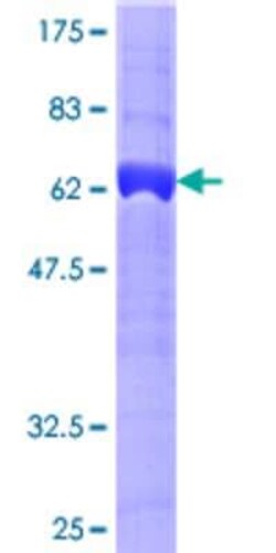 Novus Biologicals Recombinant Human Centaurin alpha 1 GST (N-Term) Protein 25 &mu;g | Buy Online | Novus Biologicals&trade; | Fisher Scientific