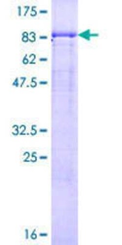 Novus Biologicals Recombinant Human GTF2A1L GST (N-Term) Protein 25 &mu;g | Buy Online | Novus Biologicals&trade; | Fisher Scientific