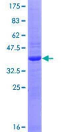 Novus Biologicals Recombinant Human SMA4 GST (N-Term) Protein 10 &mu;g | Buy Online | Novus Biologicals&trade; | Fisher Scientific