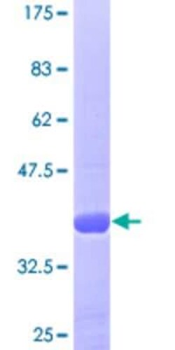 Novus Biologicals Recombinant Human DNA polymerase sigma GST (N-Term) Protein 25 &mu;g | Buy Online | Novus Biologicals&trade; | Fisher Scientific