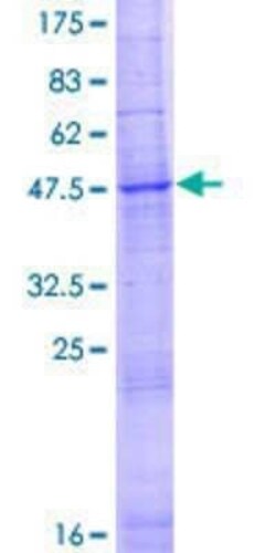 Novus Biologicals Recombinant Human SLC35D2 GST (N-Term) Protein 10 &mu;g | Buy Online | Novus Biologicals&trade; | Fisher Scientific