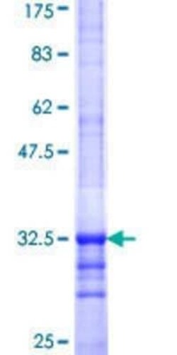 Novus Biologicals Recombinant Human SLC35D2 GST (N-Term) Protein 25 &mu;g | Buy Online | Novus Biologicals&trade; | Fisher Scientific