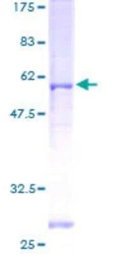 Novus Biologicals Recombinant Human ZPBP GST (N-Term) Protein 2 &mu;g | Buy Online | Novus Biologicals&trade; | Fisher Scientific