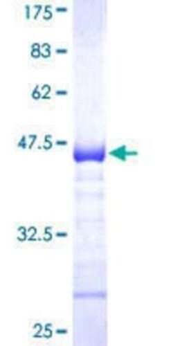 Novus Biologicals Recombinant Human WWP1 GST (N-Term) Protein 25 &mu;g | Buy Online | Novus Biologicals&trade; | Fisher Scientific