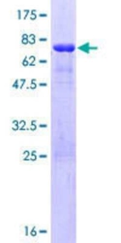 Novus Biologicals Recombinant Human WWP2 GST (N-Term) Protein 10 &mu;g | Buy Online | Novus Biologicals&trade; | Fisher Scientific
