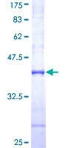 Novus Biologicals Recombinant Human WWP2 GST (N-Term) Protein 2 &mu;g | Buy Online | Novus Biologicals&trade; | Fisher Scientific