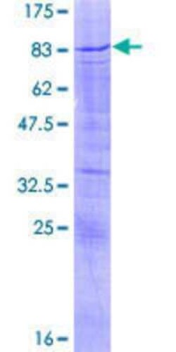 Novus Biologicals Recombinant Human SOX30 GST (N-Term) Protein 2 &mu;g | Buy Online | Novus Biologicals&trade; | Fisher Scientific