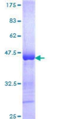 Novus Biologicals Recombinant Human SOX30 GST (N-Term) Protein 10 &mu;g | Buy Online | Novus Biologicals&trade; | Fisher Scientific