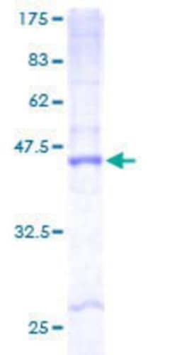 Novus Biologicals Recombinant Human CYB561D2 GST (N-Term) Protein 25 &mu;g | Buy Online | Novus Biologicals&trade; | Fisher Scientific