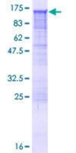 Novus Biologicals Recombinant Human Epac2 GST (N-Term) Protein 10 &mu;g | Buy Online | Novus Biologicals&trade; | Fisher Scientific