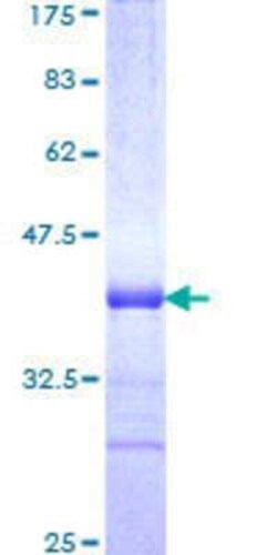 Novus Biologicals Recombinant Human TRIM31 GST (N-Term) Protein 25 &mu;g | Buy Online | Novus Biologicals&trade; | Fisher Scientific