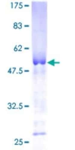 Novus Biologicals Recombinant Human TPPP/p25 GST (N-Term) Protein 2 &mu;g | Buy Online | Novus Biologicals&trade; | Fisher Scientific