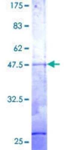 Novus Biologicals Recombinant Human RER1 GST (N-Term) Protein 25 &mu;g | Buy Online | Novus Biologicals&trade; | Fisher Scientific