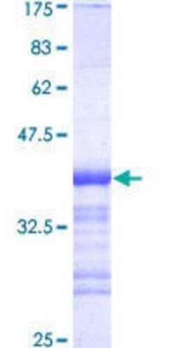 Novus Biologicals Recombinant Human DIDO1 GST (N-Term) Protein 25 &mu;g | Buy Online | Novus Biologicals&trade; | Fisher Scientific
