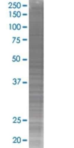 Novus Biologicals™ DIDO1 293T Cell Transient Overexpression Lysate