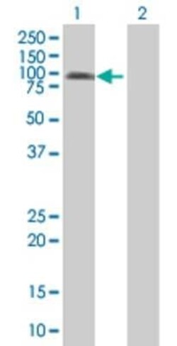 Novus Biologicals DIDO1 293T Cell Transient Overexpression Lysate 0.1 mL | Buy Online | Novus Biologicals&trade; | Fisher Scientific