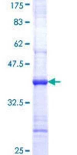 Novus Biologicals Recombinant Human ADAM30 GST (N-Term) Protein 10 &mu;g | Buy Online | Novus Biologicals&trade; | Fisher Scientific