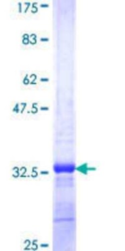 Novus Biologicals Recombinant Human ADAM29 GST (N-Term) Protein 25 &mu;g | Buy Online | Novus Biologicals&trade; | Fisher Scientific