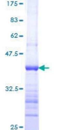 Novus Biologicals Recombinant Human ADAMTS8 GST (N-Term) Protein 10 &mu;g | Buy Online | Novus Biologicals&trade; | Fisher Scientific