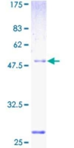 Novus Biologicals Recombinant Human NUPL2 GST (N-Term) Protein 2 &mu;g | Buy Online | Novus Biologicals&trade; | Fisher Scientific