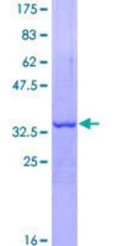 Novus Biologicals Recombinant Human ATE1 GST (N-Term) Protein 10 &mu;g | Buy Online | Novus Biologicals&trade; | Fisher Scientific
