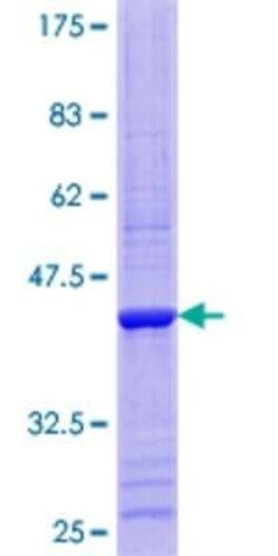 Novus Biologicals Recombinant Human RPP14 GST (N-Term) Protein 10 &mu;g | Buy Online | Novus Biologicals&trade; | Fisher Scientific