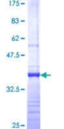 Novus Biologicals Recombinant Human RPP14 GST (N-Term) Protein 10 &mu;g | Buy Online | Novus Biologicals&trade; | Fisher Scientific