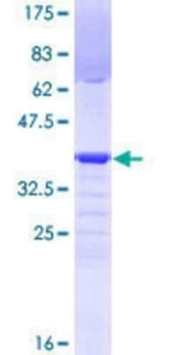 Novus Biologicals Recombinant Human PRDM4 GST (N-Term) Protein 10 &mu;g | Buy Online | Novus Biologicals&trade; | Fisher Scientific
