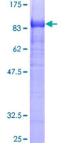 Novus Biologicals Recombinant Human FAF1 GST (N-Term) Protein 10 &mu;g | Buy Online | Novus Biologicals&trade; | Fisher Scientific