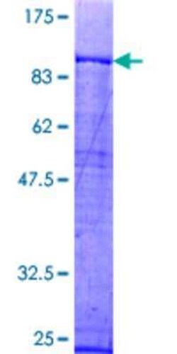 Novus Biologicals Recombinant Human FAF1 GST (N-Term) Protein 2 &mu;g | Buy Online | Novus Biologicals&trade; | Fisher Scientific