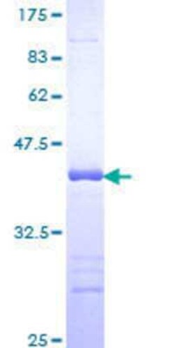 Novus Biologicals Recombinant Human FAF1 GST (N-Term) Protein 10 &mu;g | Buy Online | Novus Biologicals&trade; | Fisher Scientific
