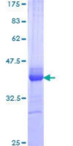 Novus Biologicals Recombinant Human TBC1D8 GST (N-Term) Protein 25 &mu;g | Buy Online | Novus Biologicals&trade; | Fisher Scientific